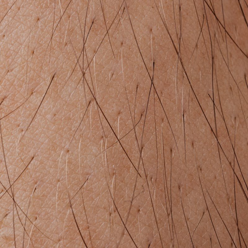Detailed macro image showing human skin texture and hair follicles.